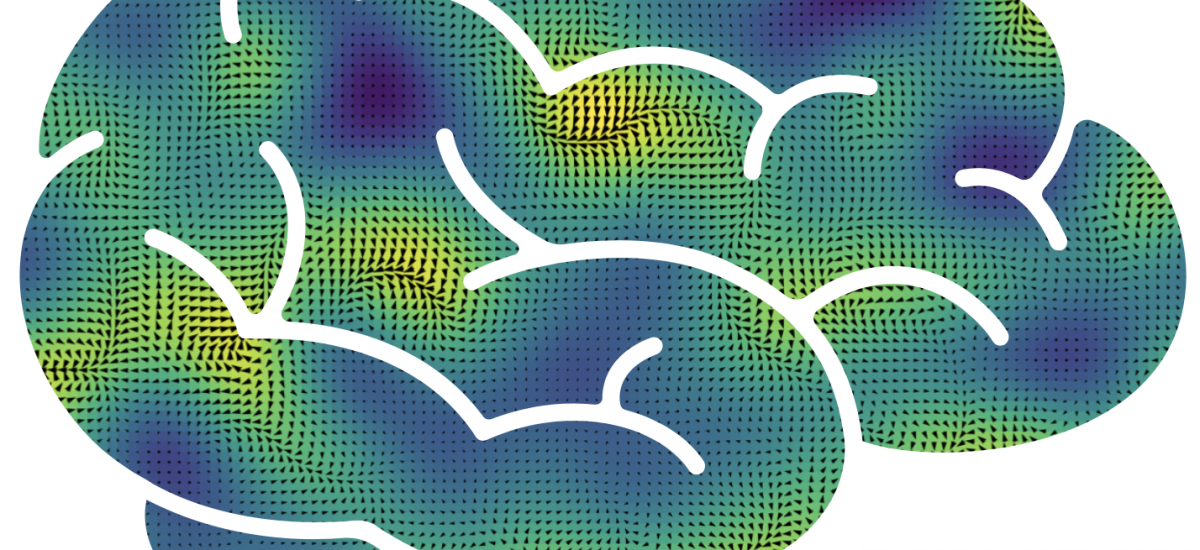 Image of brain for MAIN event